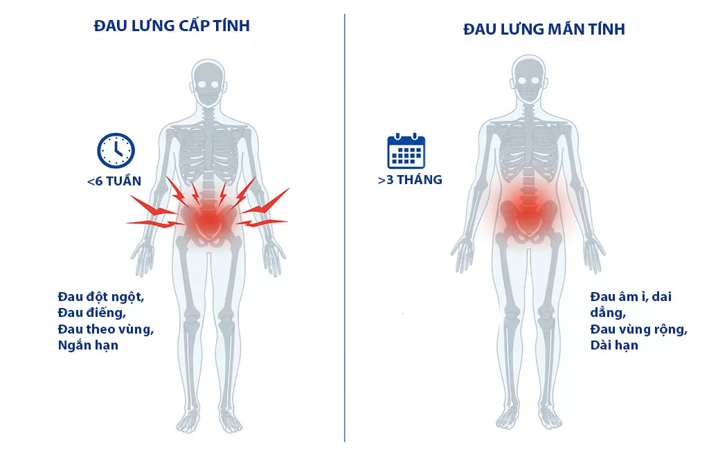 Điều trị đau lưng cột sống: Giải phải tự nhiên từ Y học cổ truyền