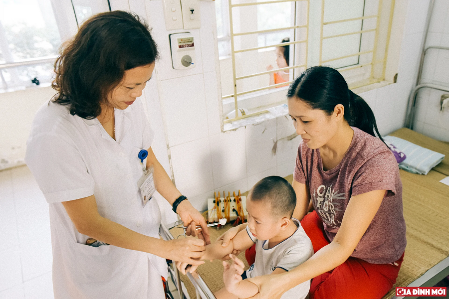 Châm cứu cho trẻ bại não - Bệnh viện châm cứu Trung ương.