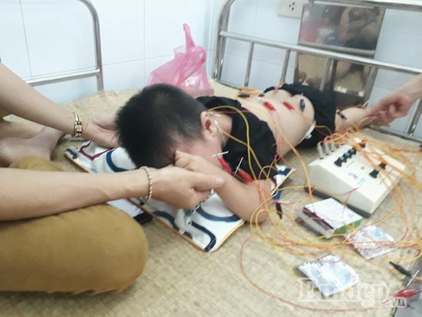 Điều trị và chăm sóc đặc biệt cho trẻ liệt vận động, ngôn ngữ