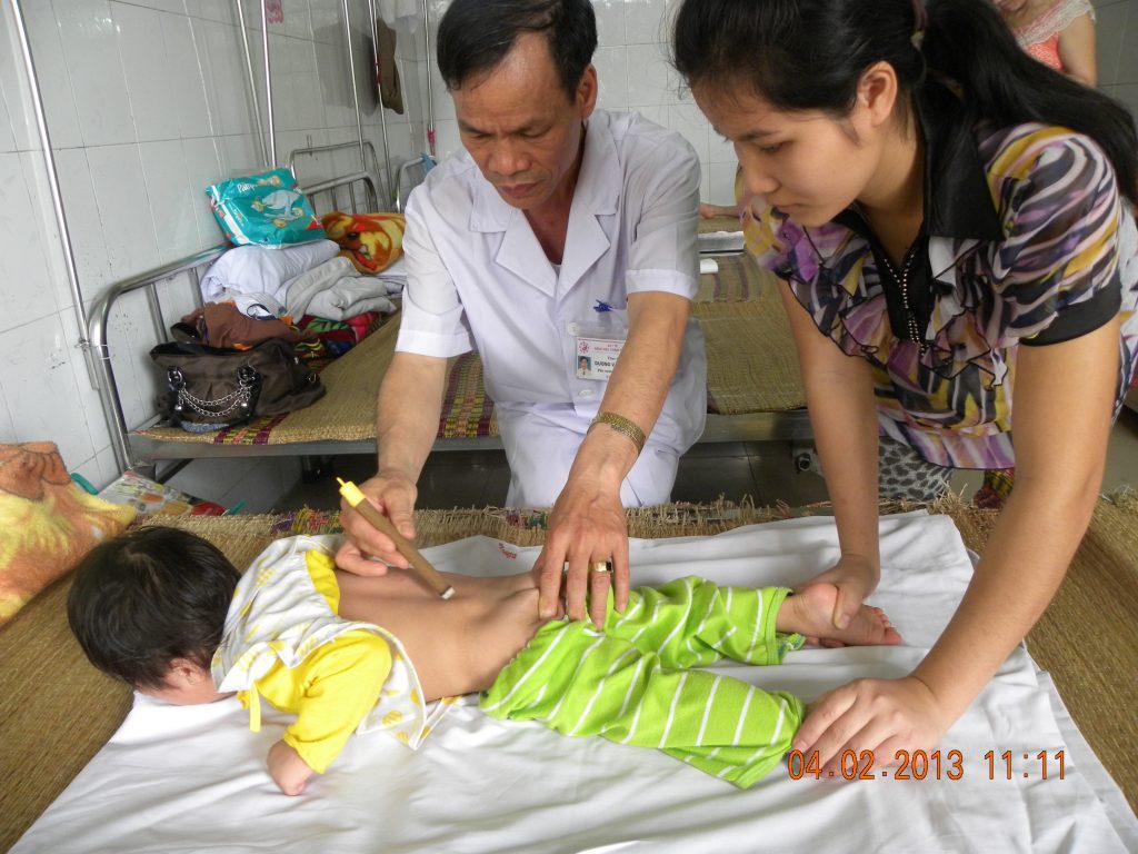 Chữa tự kỷ bằng châm cứu