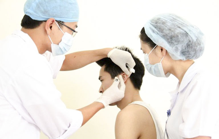 Cấy chỉ điều trị tâm căn suy nhược