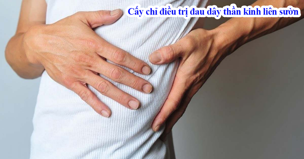 Cấy chỉ điều trị đau dây thần kinh liên sườn