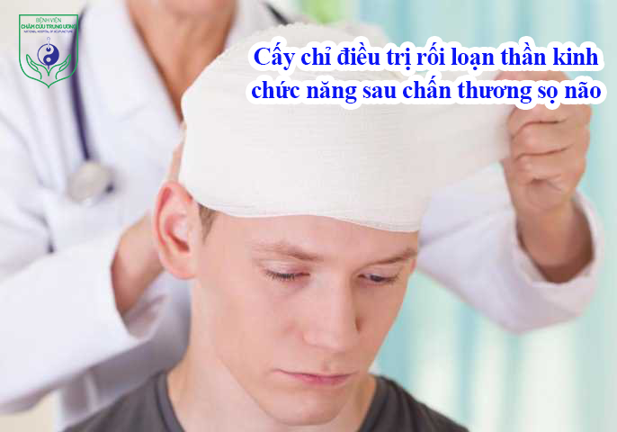 Cấy chỉ điều trị rối loạn thần kinh chức năng sau chấn thương sọ não