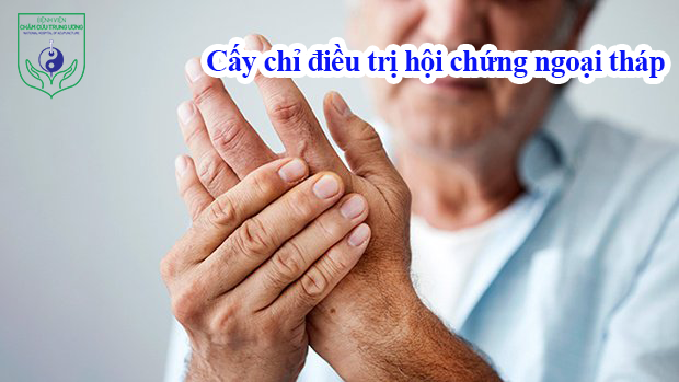 Cấy chỉ điều trị hội chứng ngoại tháp