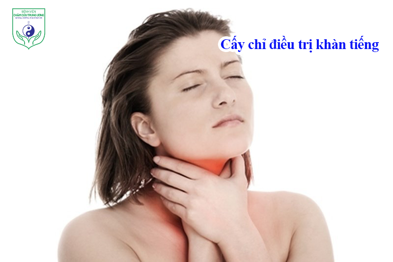 Cấy chỉ điều trị khàn tiếng