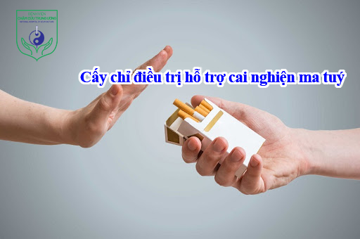 Cấy chỉ điều trị hỗ trợ cai nghiện thuốc lá