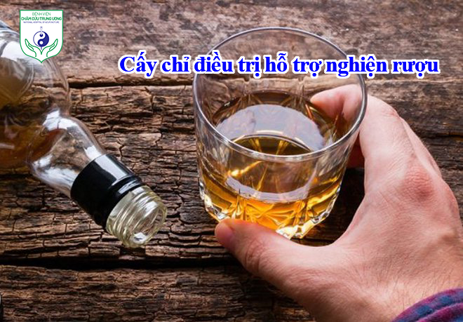 Cấy chỉ điều trị hỗ trợ nghiện rượu