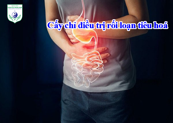 Cấy chỉ điều trị rối loạn tiêu hoá