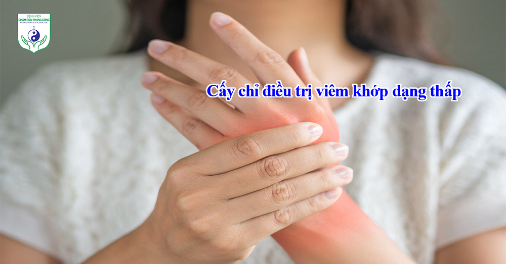 Cấy chỉ điều trị viêm khớp dạng thấp