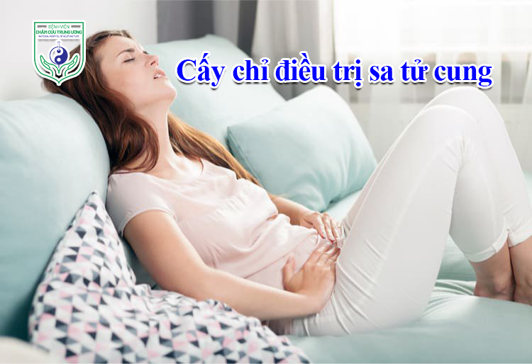 Cấy chỉ điều trị sa tử cung