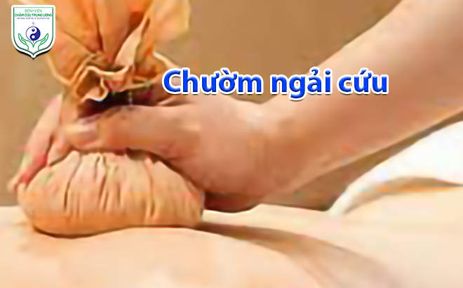 Chườm ngải cứu