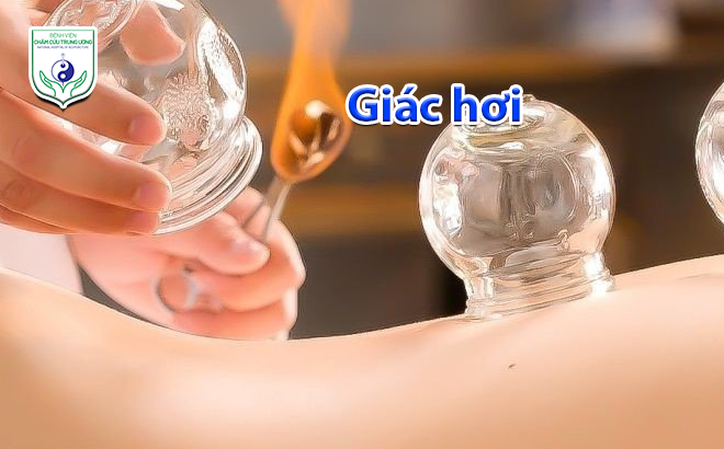 Giác hơi