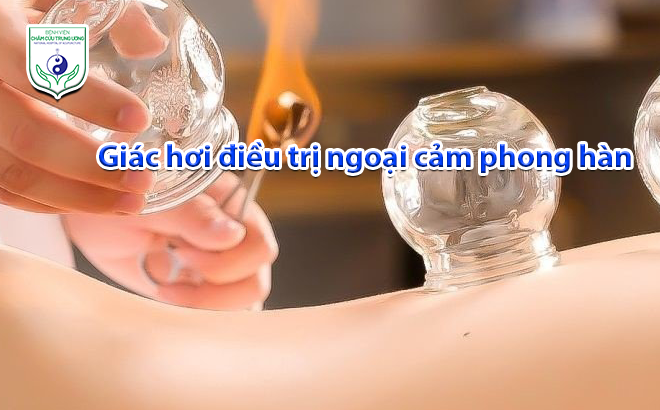 Giác hơi điều trị ngoại cảm phong hàn
