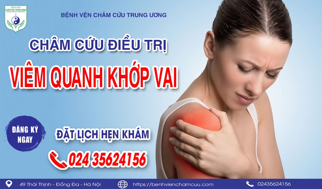 Châm cứu điều trị viêm quanh khớp vai