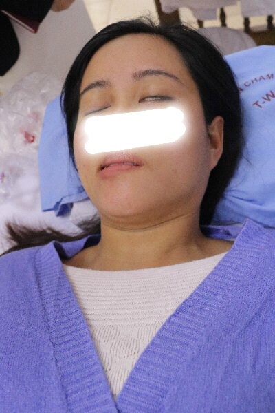 Lạm dụng điều hoà trong ngày nắng nóng, cẩn thận bệnh liệt mặt