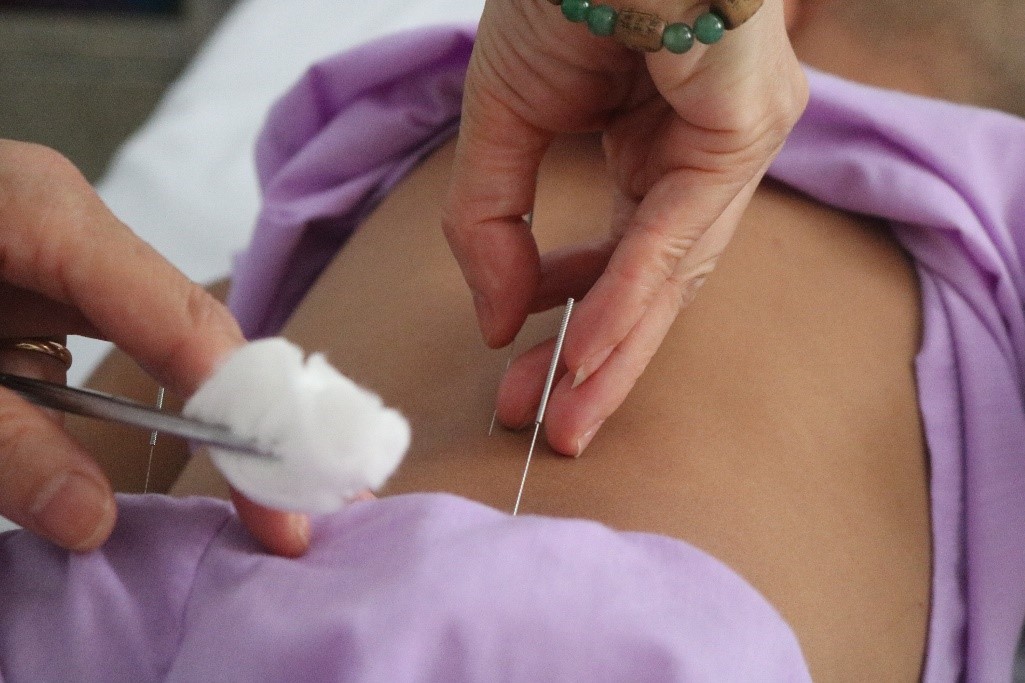 TRADITIONAL MEDICINE COMBINED WITH MODERN MEDICINE TREATMENT FOR PEDIATRIC PATIENTS WITH CEREBRAL PALSY  AT THE NATIONAL HOSPITAL OF ACUPUNCTURE.