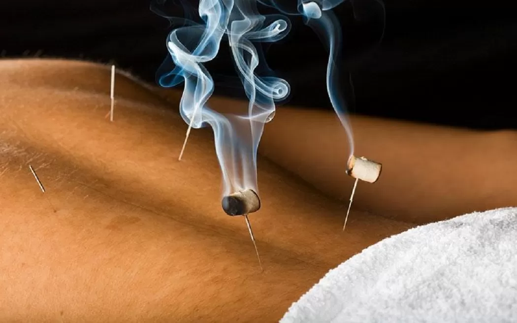 Nhiệt châm là gì? Cơ chế tác động của nhiệt châm ra sao và những thông tin hữu ích