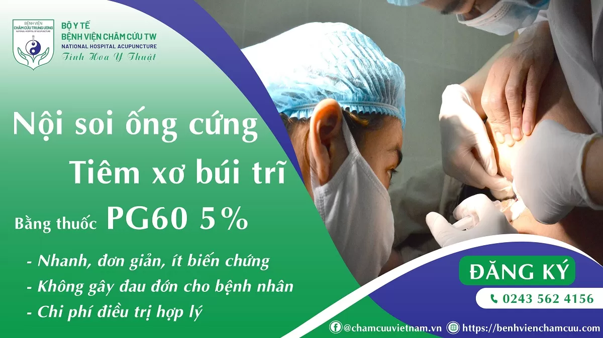 Phương pháp nội soi ống cứng - Tiêm xơ búi trĩ bằng thuốc PG 60 5%