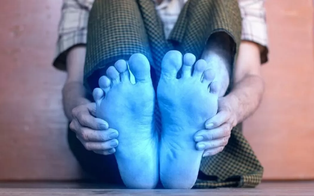 Tay chân lạnh không rõ nguyên nhân? Bài viết này sẽ giải đáp cho bạn